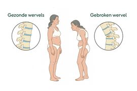 Tekening van iemand met een gebroken wervel.